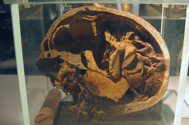 20060323v_LuxorMummifiedSkull